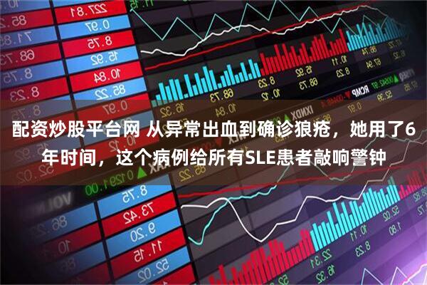 配资炒股平台网 从异常出血到确诊狼疮，她用了6年时间，这个病例给所有SLE患者敲响警钟
